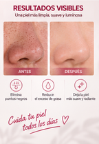 Limpiador Facial de Poros Eléctrico